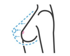 Clínica cirugía plástica Barcelona
