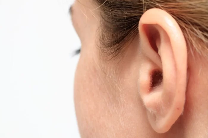 ¿La otoplastia solo es para corregir las orejas de soplillo?